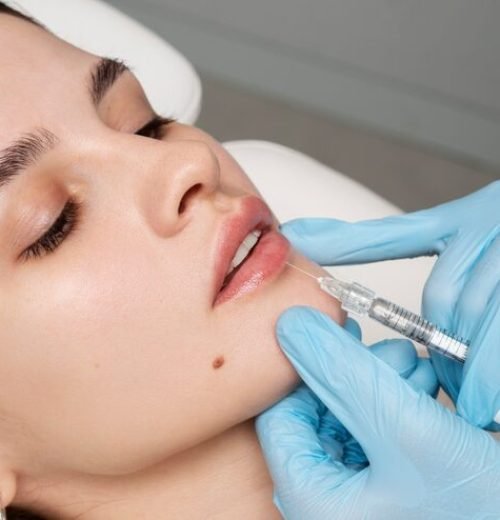 close-up-woman-getting-lip-fillers_23-2149341847 (1)
