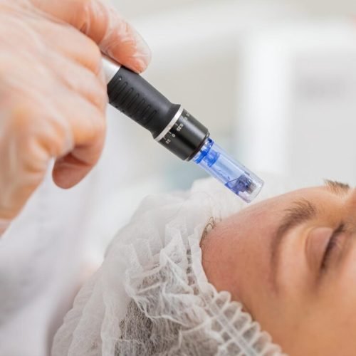 cosmetologist-doing-peeling-procedure-woman-skin-regeneration-dermapen-microneedling-dermastamp_191803-7124